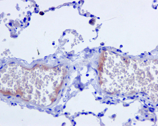 Immunohistochemistry (Formalin/PFA-fixed paraffin-embedded sections) - Anti-C4d antibody [EPR10143] - BSA and Azide free (AB249610)