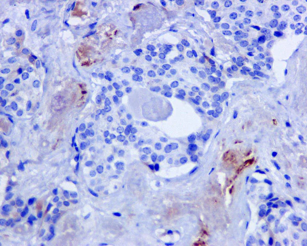 Immunohistochemistry (Formalin/PFA-fixed paraffin-embedded sections) - Anti-C4d antibody [EPR10143] - BSA and Azide free (AB249610)