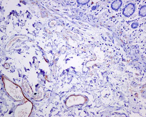 Immunohistochemistry (Formalin/PFA-fixed paraffin-embedded sections) - Anti-C4d antibody [EPR10143] - BSA and Azide free (AB249610)