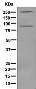 Western blot - Anti-C4d antibody [EPR10143] - BSA and Azide free (AB249610)