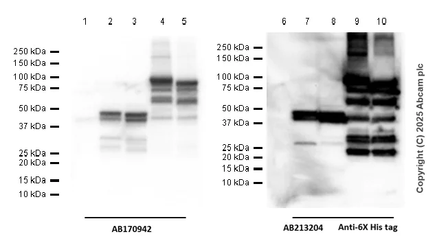 Western blot - Anti-C4d antibody [EPR10143] - BSA and Azide free (AB249610)