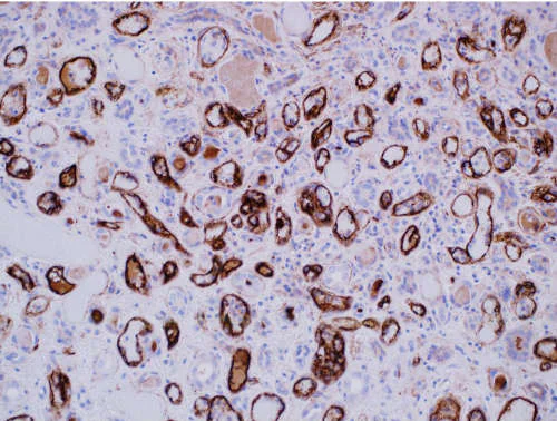 Immunohistochemistry (Formalin/PFA-fixed paraffin-embedded sections) - Anti-C4d antibody [LP69] (AB167093)