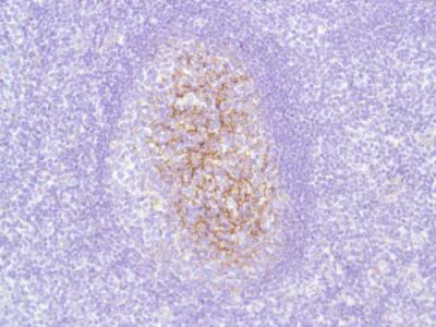 Immunohistochemistry (Formalin/PFA-fixed paraffin-embedded sections) - Anti-C4d antibody [SP91] - BSA and Azide free (AB236231)