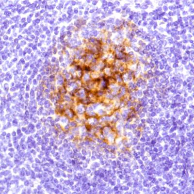 Immunohistochemistry (Formalin/PFA-fixed paraffin-embedded sections) - Anti-C4d antibody [SP91] - BSA and Azide free (AB236231)