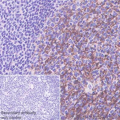 Immunohistochemistry (Formalin/PFA-fixed paraffin-embedded sections) - Anti-C4d antibody [SP91] - C-terminal (AB183311)