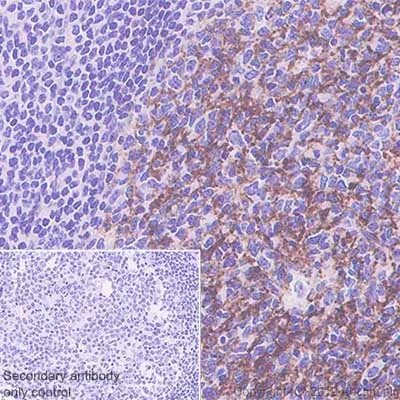 Immunohistochemistry (Formalin/PFA-fixed paraffin-embedded sections) - Anti-C4d antibody [SP91] - C-terminal (AB183311)