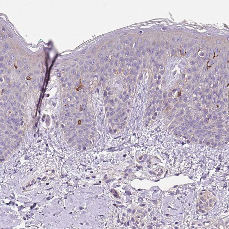 Immunohistochemistry (Formalin/PFA-fixed paraffin-embedded sections) - Anti-C4orf48 antibody (AB185315)