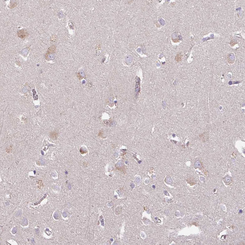 Immunohistochemistry (Formalin/PFA-fixed paraffin-embedded sections) - Anti-C4orf48 antibody (AB185315)