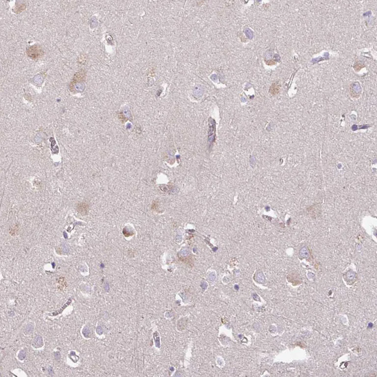Immunohistochemistry (Formalin/PFA-fixed paraffin-embedded sections) - Anti-C4orf48 antibody (AB185315)