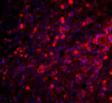 Immunohistochemistry (Formalin/PFA-fixed paraffin-embedded sections) - Anti-C5 antibody (AB217027)