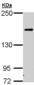 Western blot - Anti-C5 antibody (AB97465)
