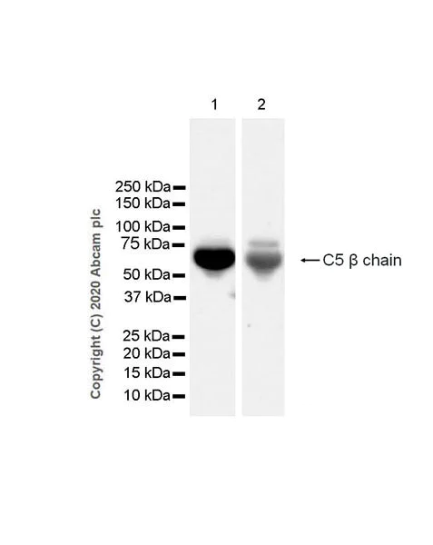 Western blot - Anti-C5 / C5b antibody [EPR23940-3] (AB275931)