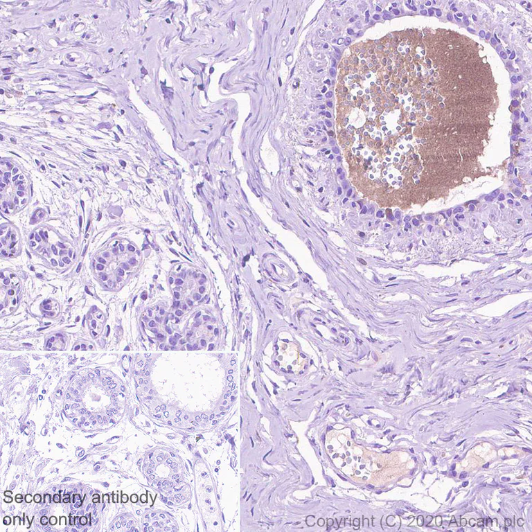 Immunohistochemistry (Formalin/PFA-fixed paraffin-embedded sections) - Anti-C5 / C5b antibody [EPR23940-3] - BSA and Azide free (AB275933)