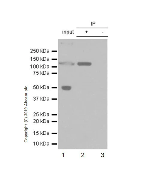 Immunoprecipitation - Anti-C5a antibody [EPR19699-24] - BSA and Azide free (AB256354)