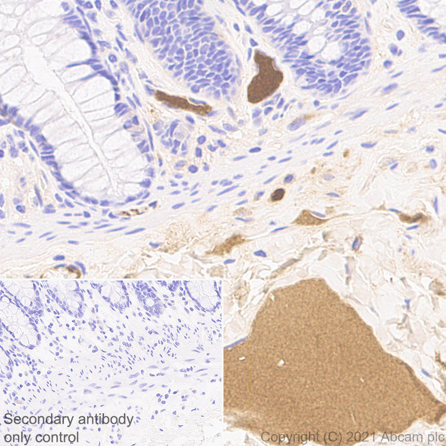 Immunohistochemistry (Formalin/PFA-fixed paraffin-embedded sections) - Anti-C5a antibody [EPR24303-10] - BSA and Azide free (AB281943), expandable thumbnail