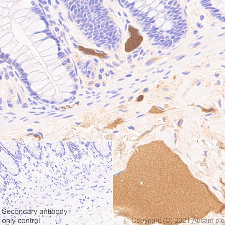 Immunohistochemistry (Formalin/PFA-fixed paraffin-embedded sections) - Anti-C5a antibody [EPR24303-10] - BSA and Azide free (AB281943)