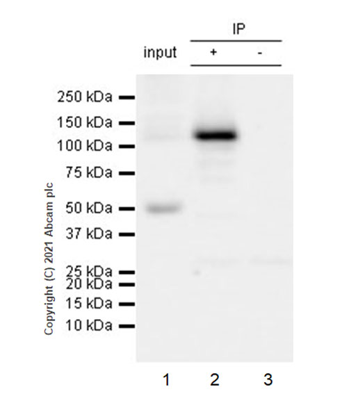 Immunoprecipitation - Anti-C5a antibody [EPR24303-10] - BSA and Azide free (AB281943), expandable thumbnail
