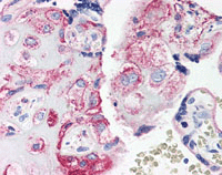 Immunohistochemistry (Formalin/PFA-fixed paraffin-embedded sections) - Anti-C5a-R antibody (AB115296)