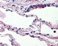 Immunohistochemistry (Formalin/PFA-fixed paraffin-embedded sections) - Anti-C5a-R antibody (AB115296)