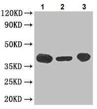 Western blot - Anti-C5a-R antibody (AB234757)