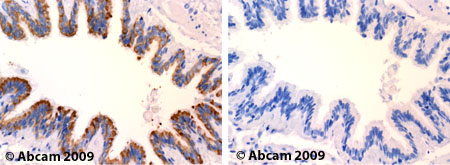 Immunohistochemistry (Formalin/PFA-fixed paraffin-embedded sections) - Anti-C5a-R antibody (AB59390), expandable thumbnail