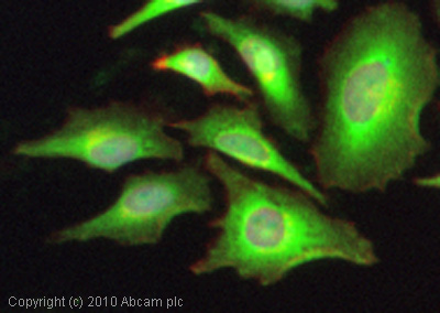 Immunocytochemistry/ Immunofluorescence - Anti-C5b-9 antibody (AB55811), expandable thumbnail