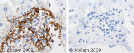 Immunohistochemistry (Formalin/PFA-fixed paraffin-embedded sections) - Anti-C5b-9 antibody (AB55811), expandable thumbnail