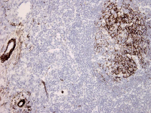 Immunohistochemistry (Frozen sections) - Anti-C5b-9 + C5b-8 antibody [aE11] (AB66768)