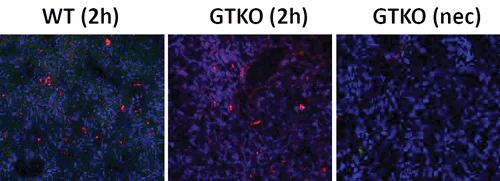 Immunohistochemistry (Frozen sections) - Anti-C5b-9 + C5b-8 antibody [aE11] (AB66768)