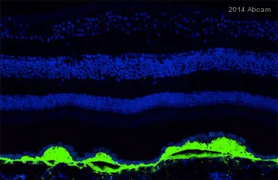Immunohistochemistry (Frozen sections) - Anti-C5b-9 + C5b-8 antibody [aE11] (AB66768)