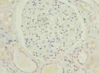 Immunohistochemistry (Formalin/PFA-fixed paraffin-embedded sections) - Anti-C5orf24 antibody (AB235404), expandable thumbnail