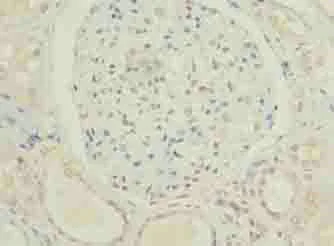 Immunohistochemistry (Formalin/PFA-fixed paraffin-embedded sections) - Anti-C5orf24 antibody (AB235404)