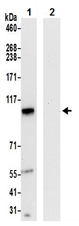 Immunoprecipitation - Anti-C5orf25 antibody (AB241985)