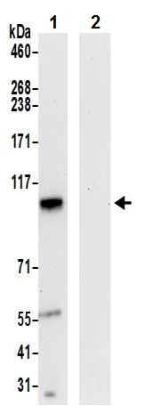 Immunoprecipitation - Anti-C5orf25 antibody (AB241985)