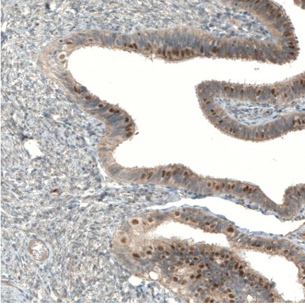 Immunohistochemistry (Formalin/PFA-fixed paraffin-embedded sections) - Anti-C5orf45 antibody (AB150917), expandable thumbnail