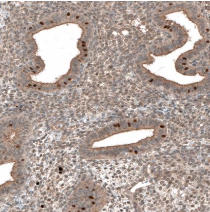 Immunohistochemistry (Formalin/PFA-fixed paraffin-embedded sections) - Anti-C5orf45 antibody (AB150917), expandable thumbnail