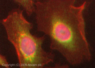 Immunocytochemistry/ Immunofluorescence - Anti-C6 antibody (AB74638)