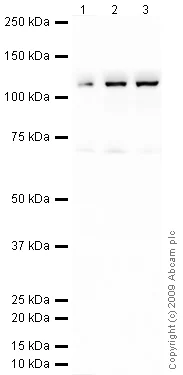 Western blot - Anti-C6 antibody (AB74638)