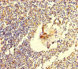Immunohistochemistry (Formalin/PFA-fixed paraffin-embedded sections) - Anti-C6ORF10 antibody (AB222839)