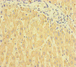 Immunohistochemistry (Formalin/PFA-fixed paraffin-embedded sections) - Anti-C6ORF10 antibody (AB222839)