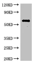 Western blot - Anti-C6ORF10 antibody (AB222839)