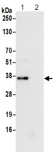 Immunoprecipitation - Anti-C6orf106 antibody (AB195313)