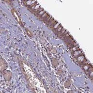 Immunohistochemistry (Formalin/PFA-fixed paraffin-embedded sections) - Anti-C6orf129 antibody (AB126337)