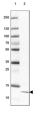 Western blot - Anti-C6orf129 antibody (AB126337), expandable thumbnail