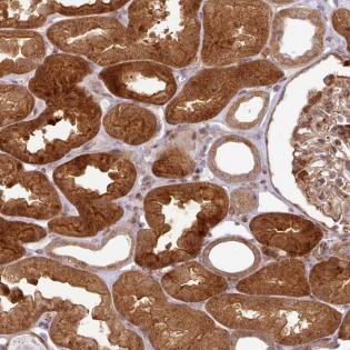Immunohistochemistry (Formalin/PFA-fixed paraffin-embedded sections) - Anti-C6orf134/TAT antibody (AB184778)