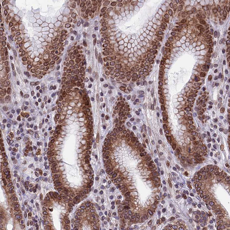 Immunohistochemistry (Formalin/PFA-fixed paraffin-embedded sections) - Anti-C6orf138 antibody (AB122705), expandable thumbnail