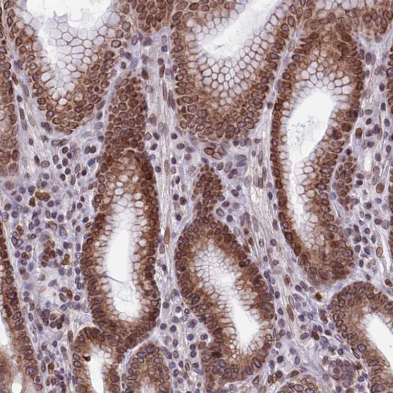 Immunohistochemistry (Formalin/PFA-fixed paraffin-embedded sections) - Anti-C6orf138 antibody (AB122705)