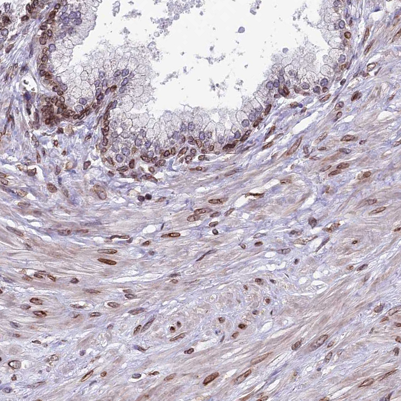 Immunohistochemistry (Formalin/PFA-fixed paraffin-embedded sections) - Anti-C6orf138 antibody (AB122705), expandable thumbnail