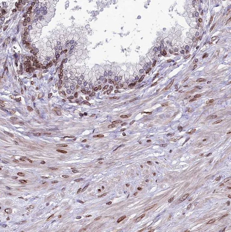 Immunohistochemistry (Formalin/PFA-fixed paraffin-embedded sections) - Anti-C6orf138 antibody (AB122705)
