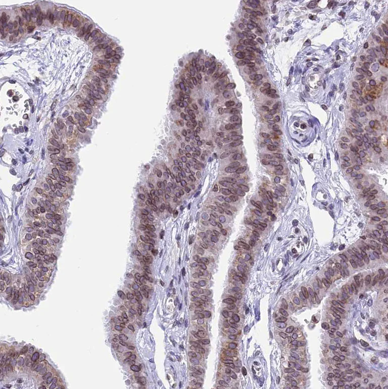 Immunohistochemistry (Formalin/PFA-fixed paraffin-embedded sections) - Anti-C6orf138 antibody (AB122705)